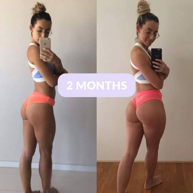 FlexiaFit™ - EMS Buttocks Stimulator