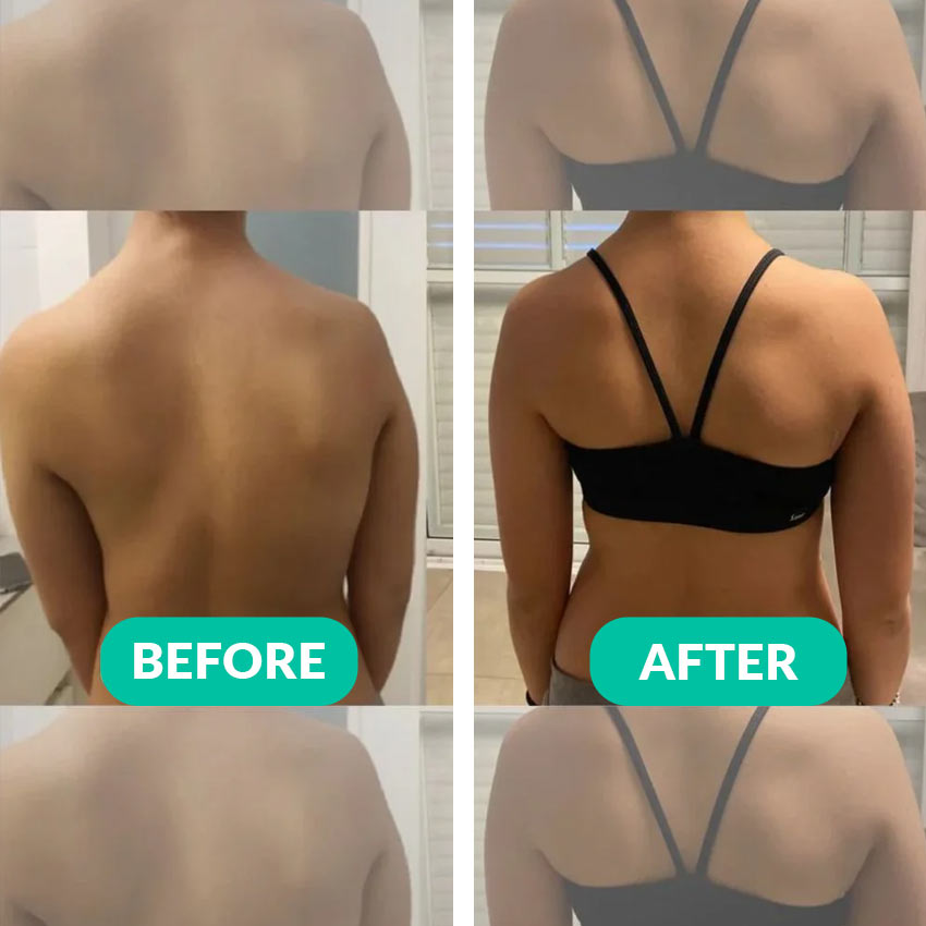 RESULTS-POSTURE-CORRECTOR