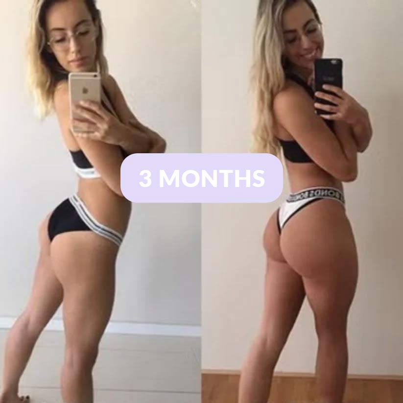 FlexiaFit™ - EMS Buttocks Stimulator